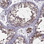 NECAB3 Polyclonal Antibody