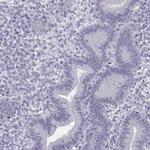 MROH7 Polyclonal Antibody