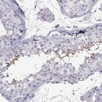 MROH7 Antibody in Immunohistochemistry (Paraffin) (IHC (P))