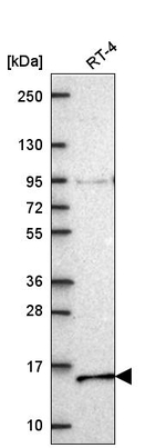 NDUFA7 Antibody in Western Blot (WB)