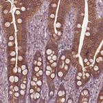 ITFG3 Polyclonal Antibody