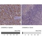 CASKIN2 Antibody