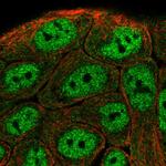 TNIP1 Polyclonal Antibody