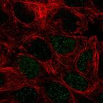 PEPD Polyclonal Antibody