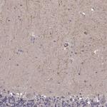 RIT2 Antibody in Immunohistochemistry (Paraffin) (IHC (P))