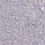 RIT2 Antibody in Immunohistochemistry (Paraffin) (IHC (P))