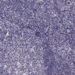 RIT2 Antibody in Immunohistochemistry (Paraffin) (IHC (P))