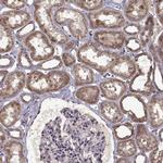 C2orf47 Polyclonal Antibody