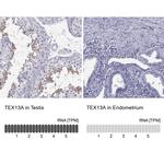 TEX13A Antibody
