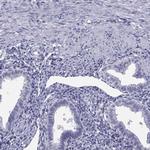 TEX13A Polyclonal Antibody