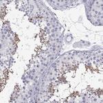 TEX13A Antibody in Immunohistochemistry (Paraffin) (IHC (P))