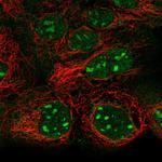 SNAPC1 Polyclonal Antibody