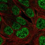 PLAG1 Polyclonal Antibody