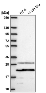 PMEPA1 Antibody in Western Blot (WB)