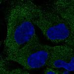 PAIP2B Polyclonal Antibody