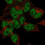 CRMP5 Polyclonal Antibody