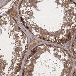 TXLNA Antibody in Immunohistochemistry (Paraffin) (IHC (P))