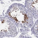 CXorf41 Antibody in Immunohistochemistry (Paraffin) (IHC (P))