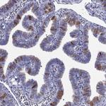 CXorf41 Antibody in Immunohistochemistry (Paraffin) (IHC (P))