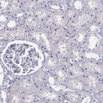CXorf41 Antibody in Immunohistochemistry (Paraffin) (IHC (P))