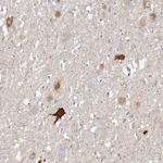 VGF Antibody in Immunohistochemistry (Paraffin) (IHC (P))