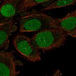 ORC6 Polyclonal Antibody