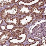 TMEM254 Polyclonal Antibody