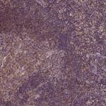 CPNE1 Polyclonal Antibody