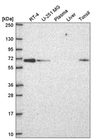 CPNE1 Antibody in Western Blot (WB)