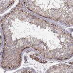 CMTM3 Polyclonal Antibody