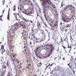 PLCH2 Polyclonal Antibody