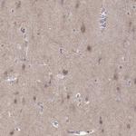 Abl2 Antibody in Immunohistochemistry (Paraffin) (IHC (P))