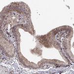 Abl2 Antibody in Immunohistochemistry (Paraffin) (IHC (P))