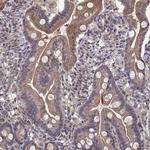 Abl2 Polyclonal Antibody