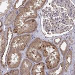 Abl2 Antibody in Immunohistochemistry (Paraffin) (IHC (P))