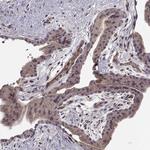 Abl2 Antibody in Immunohistochemistry (Paraffin) (IHC (P))