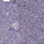 LZTR2 Polyclonal Antibody