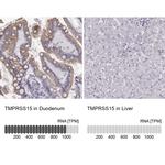 TMPRSS15 Antibody
