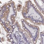 TMPRSS15 Antibody in Immunohistochemistry (Paraffin) (IHC (P))