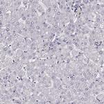 TMPRSS15 Polyclonal Antibody