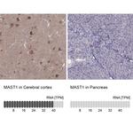 MAST1 Antibody
