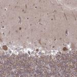 MAST1 Antibody in Immunohistochemistry (Paraffin) (IHC (P))