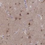 MAST1 Polyclonal Antibody