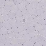 MAST1 Antibody in Immunohistochemistry (Paraffin) (IHC (P))