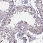 MAST1 Antibody in Immunohistochemistry (Paraffin) (IHC (P))