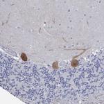 PPP1R17 Antibody in Immunohistochemistry (Paraffin) (IHC (P))