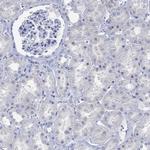 PPP1R17 Antibody in Immunohistochemistry (Paraffin) (IHC (P))
