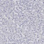 PPP1R17 Antibody in Immunohistochemistry (Paraffin) (IHC (P))