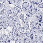 PPP1R17 Antibody in Immunohistochemistry (Paraffin) (IHC (P))