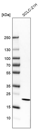 PPP1R17 Antibody in Western Blot (WB)